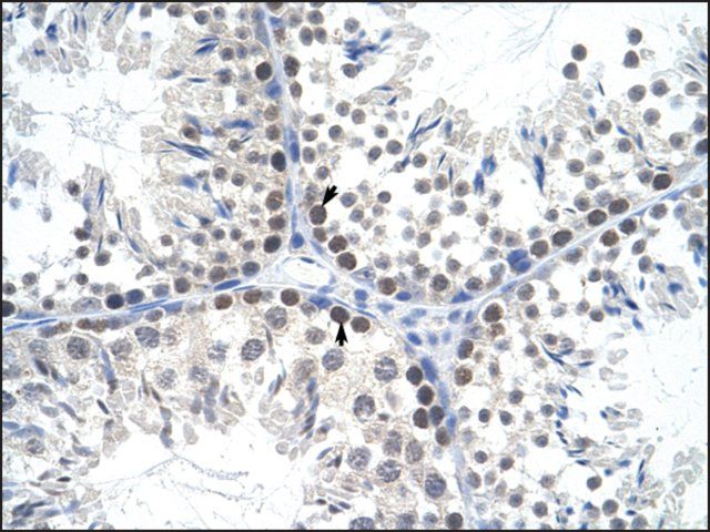 Anti-TFAM (AB3) antibody produced in rabbit