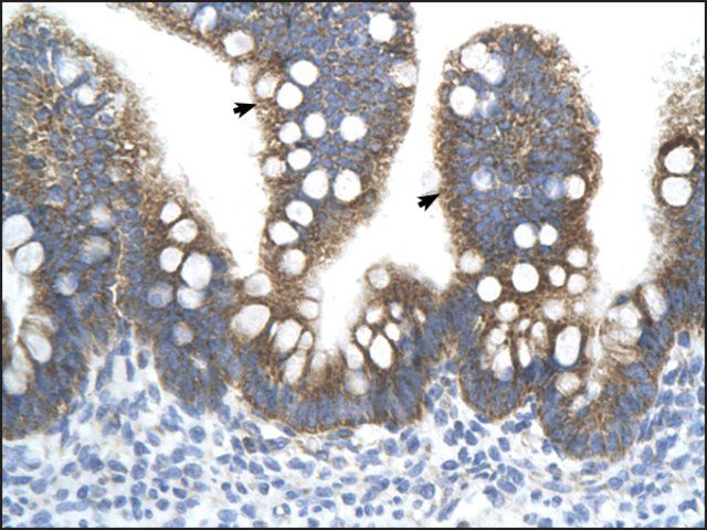 Anti-TFB2M (AB1) antibody produced in rabbit