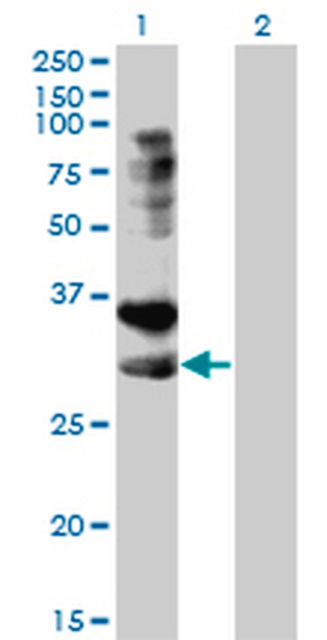 Anti-TNFRSF14 Mouse mAb (2G6-2C7)