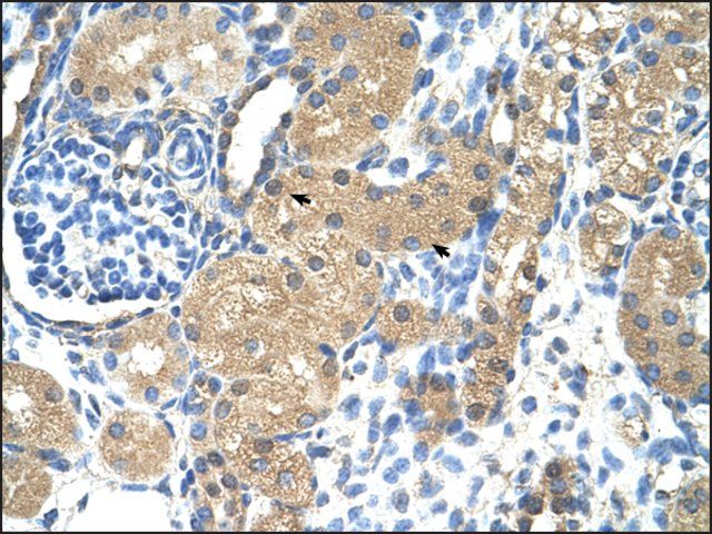 Anti-TNNI1 (AB1) antibody produced in rabbit