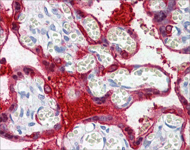 Anti-TGM2 (AB1) antibody produced in rabbit