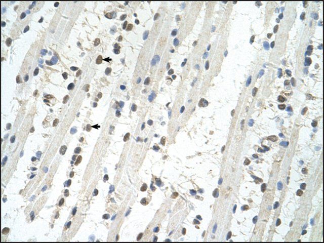 Anti-TRIM32 (AB2) antibody produced in rabbit