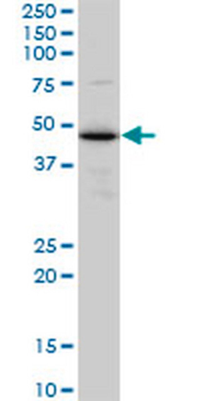 Anti-TXNDC4 Mouse mAb (3C7)