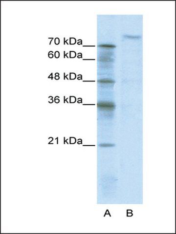 Anti-ZHX2 (AB1) antibody produced in rabbit