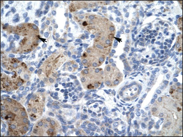 Anti-ZNF258 antibody produced in rabbit