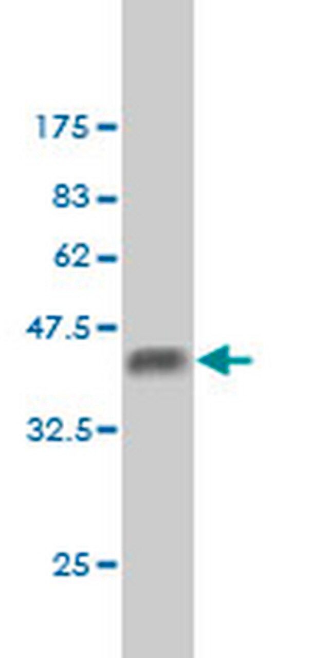Anti-BCL9 Mouse mAb (2D4)
