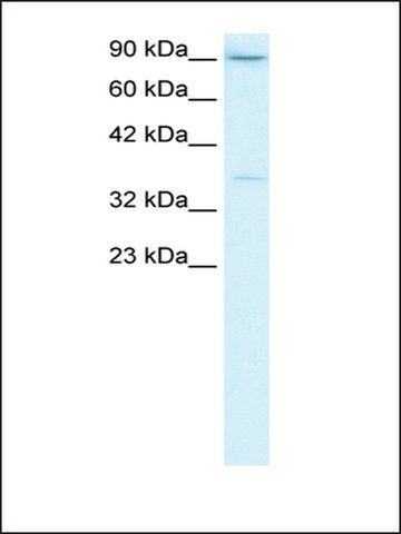 Anti-TBP from hog kidney