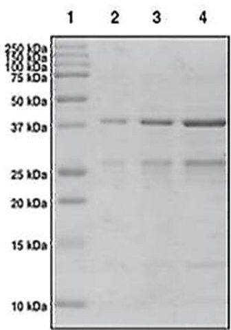 WRD9 (1310-1426) GST tag human