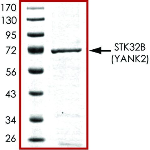STK32B active, GST tagged human