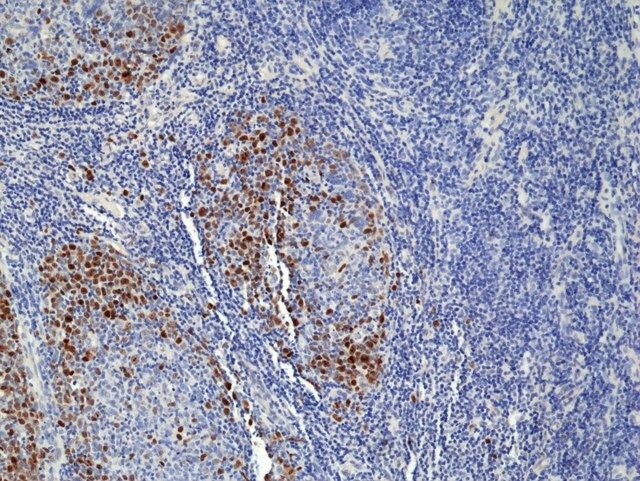 TOP2A (Topoisomerase IIα) Rabbit Monoclonal Antibody