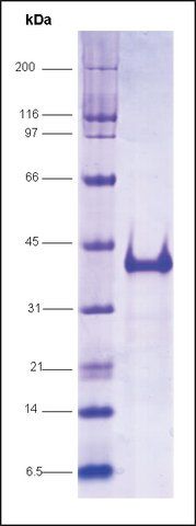 Vitamin D receptor (118-427), His tagged human