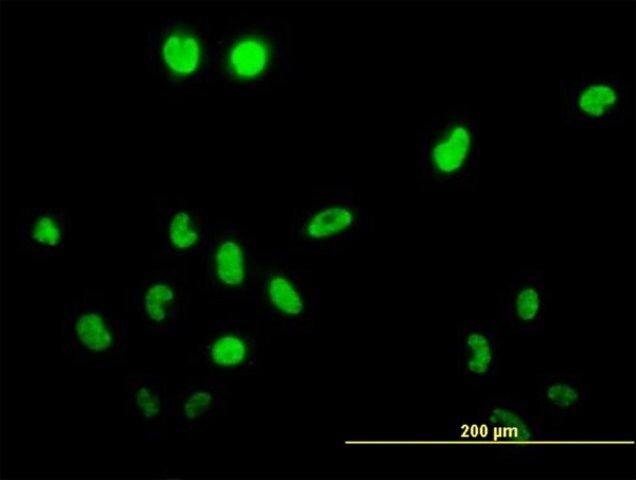 Monoclonal Anti-TSSK1, (C-terminal) antibody produced in mouse