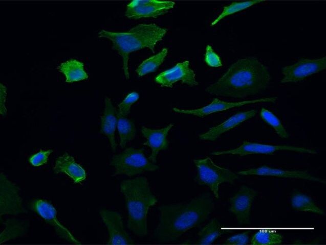 Monoclonal Anti-UMPS, (C-terminal) antibody produced in mouse