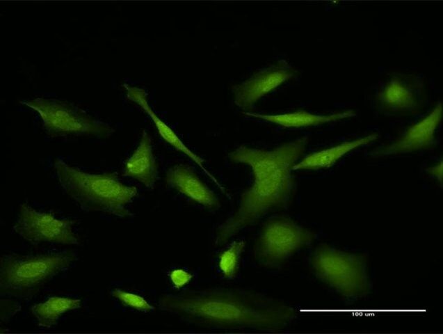 Monoclonal Anti-VDAC2 antibody produced in mouse