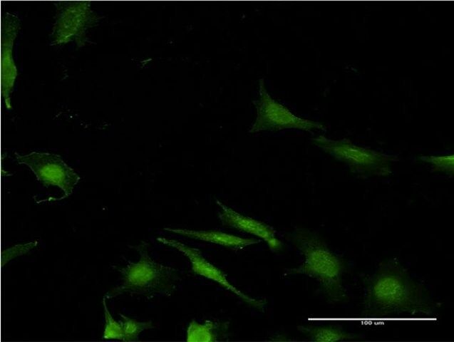 Monoclonal Anti-WBP2 antibody produced in mouse