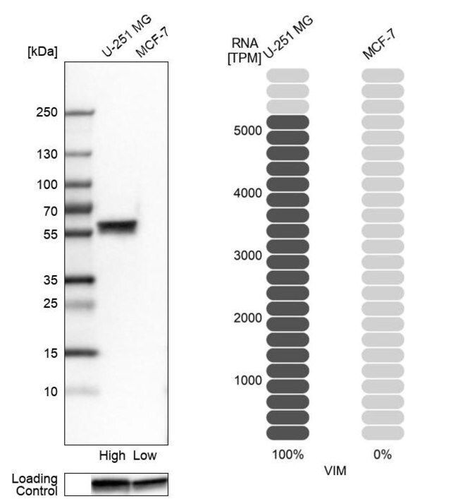 Monoclonal Anti-VIM antibody produced in mouse