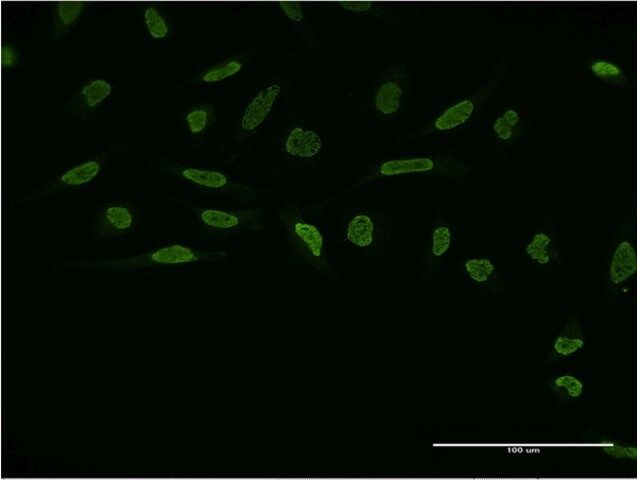 Monoclonal Anti-ZIC4 antibody produced in mouse