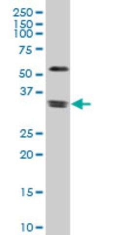 Monoclonal Anti-ZIC4 antibody produced in mouse