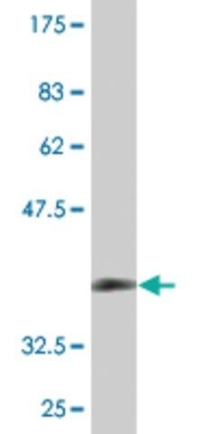 Monoclonal Anti-ZDHHC13 antibody produced in mouse