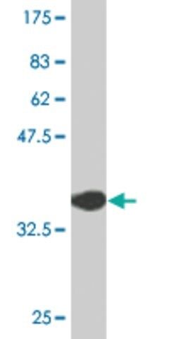 Monoclonal Anti-ZFP161 antibody produced in mouse