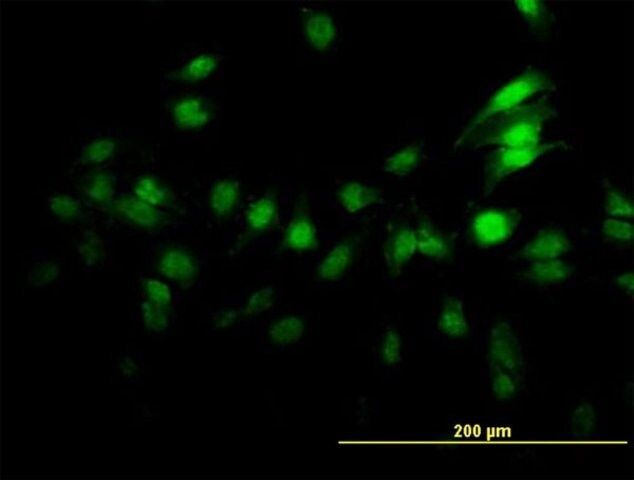 Monoclonal Anti-ZNF496 antibody produced in mouse