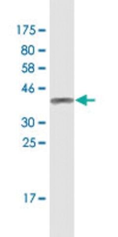 Monoclonal Anti-ZNF154, (N-terminal) antibody produced in mouse