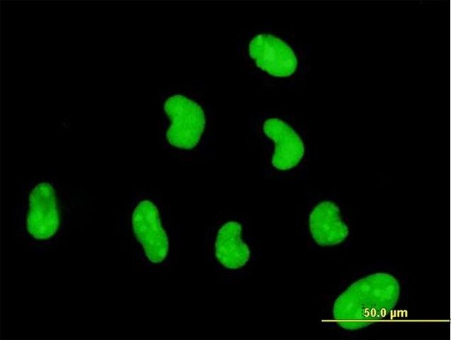 Monoclonal Anti-ZNF394 antibody produced in mouse