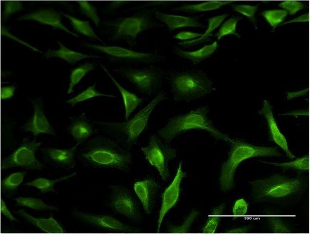 Monoclonal Anti-S100P antibody produced in mouse