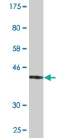 Monoclonal Anti-STUB1, (C-terminal) antibody produced in mouse