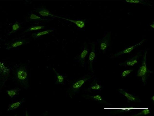 Monoclonal Anti-SUMO3 antibody produced in mouse