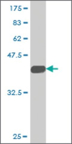 Monoclonal Anti-TAX1BP3 antibody produced in mouse