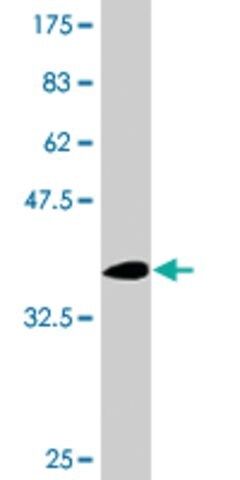 Monoclonal Anti-NCSTN antibody produced in mouse