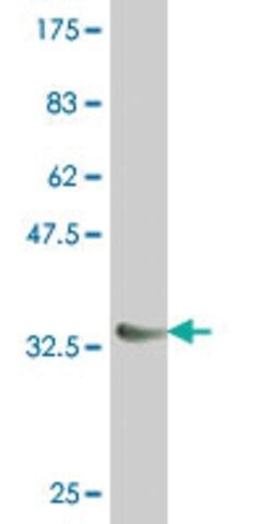 Monoclonal Anti-NKX6-1 antibody produced in mouse