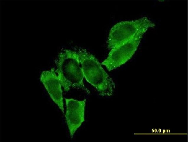 Monoclonal Anti-MMP9 antibody produced in mouse