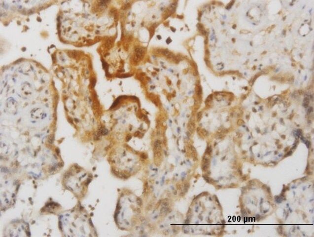 Monoclonal Anti-IL15, (C-terminal) antibody produced in mouse