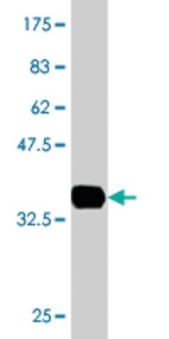 Monoclonal Anti-EPM2AIP1, (C-terminal) antibody produced in mouse
