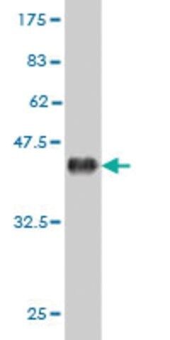 Monoclonal Anti-EPHB6 antibody produced in mouse