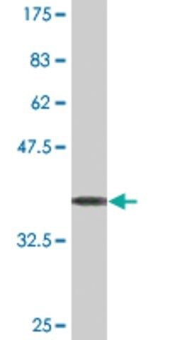 Monoclonal Anti-ENTPD4 antibody produced in mouse