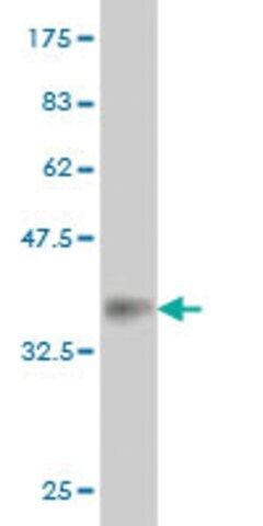 Monoclonal Anti-EPHB2 antibody produced in mouse