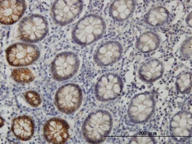 Monoclonal Anti-EPHB3, (C-terminal) antibody produced in mouse