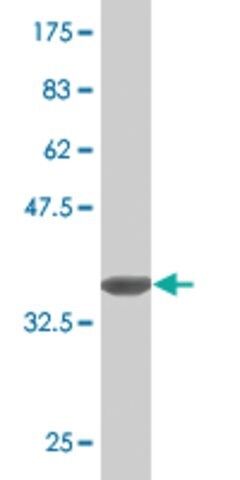Monoclonal Anti-CNKSR3 antibody produced in mouse