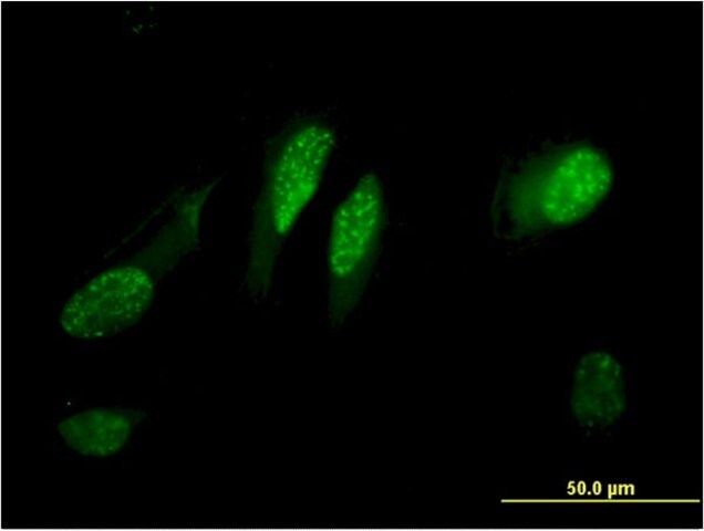 Monoclonal Anti-C13orf15 antibody produced in mouse
