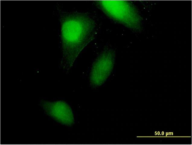 Monoclonal Anti-CRABP2 antibody produced in mouse