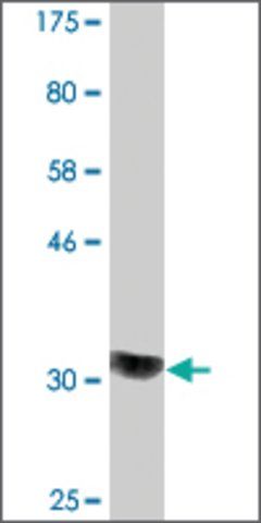 Monoclonal Anti-COQ2 antibody produced in mouse
