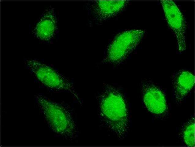 Monoclonal Anti-C18ORF23 antibody produced in mouse