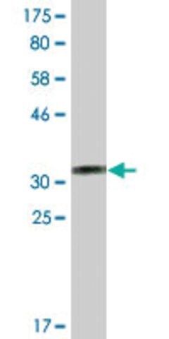 Monoclonal Anti-CRELD2 antibody produced in mouse