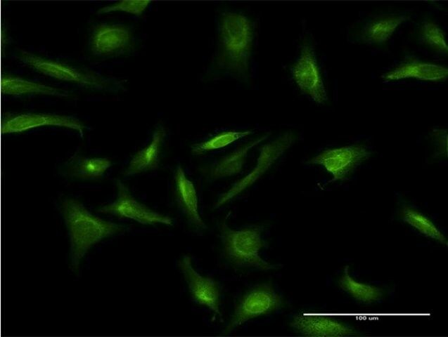 Monoclonal Anti-CRY2 antibody produced in mouse