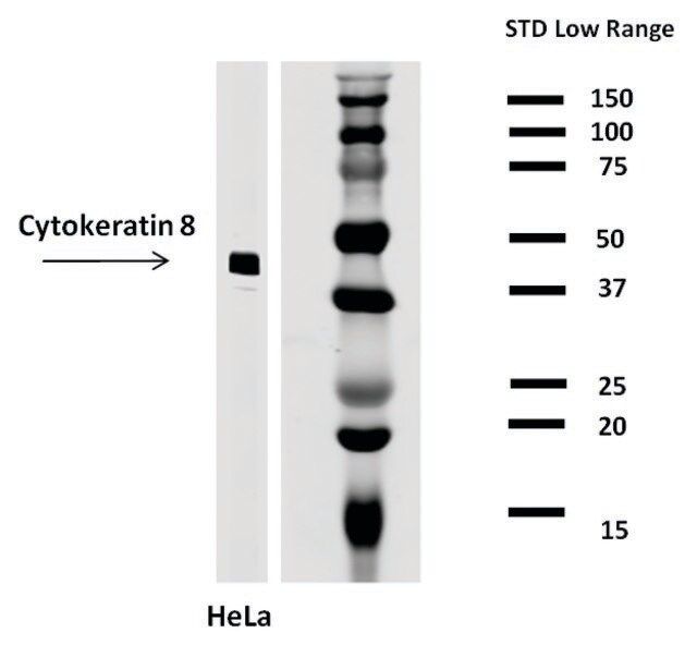 Monoclonal Anti-Cytokeratin 8 antibody produced in mouse