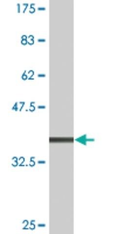 Monoclonal Anti-CSNK1G2, (C-terminal) antibody produced in mouse