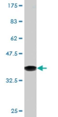Monoclonal Anti-CTNNBIP1 antibody produced in mouse